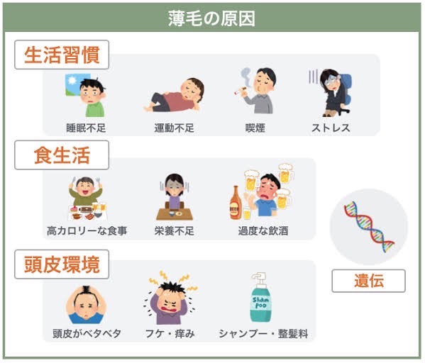 ○○が原因で髪が薄くなる可能性がある！